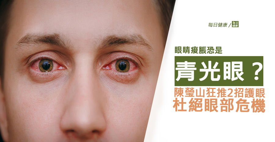 眼睛酸胀恐是青光眼?陈莹山狂推2招护眼,杜绝眼部危机