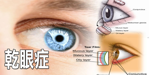 眼睛時常乾澀視線模糊？乾眼症一但發作無法根治，出現這七大症狀千萬注意！
