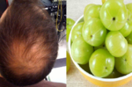 頭髮直直掉？「6種自然方法 」補足頭皮養分、促進生髮，真正逆轉「禿頭」危機！