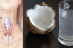 「椰子水」就是改善甲狀腺功能的神水！「7大功效」由內而外改善健康，完全零副作用。