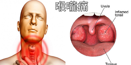 突然喉嚨好痛⋯⋯Check一下治療這種煩惱的方法☆