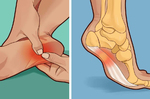 走沒幾步路腳底就痛?一秒鐘學會：3招簡單腳底按摩，坐著就可以讓你輕鬆擺脫「足底筋膜炎」
