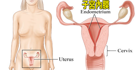 月經來總是「痛」哭流涕？當心是「子宮內膜」正在警告你的身體！女生一定要看，最嚴重恐導致「不孕症」！