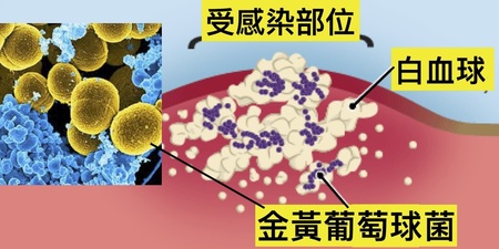 「冰箱把手」竟是細菌溫床？家中最「髒」的「七」樣東西，小心感染「金黃葡萄球菌」！