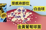 「冰箱把手」竟是細菌溫床？家中最「髒」的「七」樣東西，小心感染「金黃葡萄球菌」！