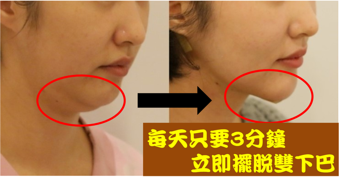 擊退雙下巴 1秒鐘學會 超簡單下巴運動 每天只要3分鐘 臉瞬間小一半 每日健康health