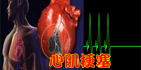 現代文明病「代謝症候群」：只要「5項中3項」提高中風、心臟病機率！1分鐘自我檢測不能等！