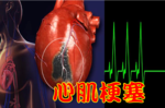 現代文明病「代謝症候群」：只要「5項中3項」提高中風、心臟病機率！1分鐘自我檢測不能等！