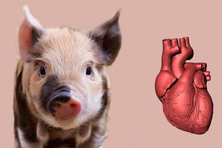 醫揭豬心人體移植病患死因　疑與豬病毒有關