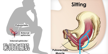 痔瘡、便祕、闌尾炎都是「坐」出來的：一秒學會「正確排便姿勢」，清空直腸毒素一身輕！