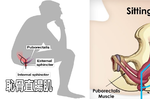 痔瘡、便祕、闌尾炎都是「坐」出來的：一秒學會「正確排便姿勢」，清空直腸毒素一身輕！
