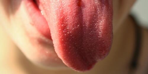 舌苔發白不可掉以輕心　NHS報導：可能是「這5大疾病」在作怪