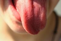 舌苔發白不可掉以輕心　NHS報導：可能是「這5大疾病」在作怪