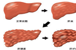 你要讓「肝臟」被「雌激素」荼毒多久？三大護肝食材這樣煮，排空肝臟毒素用「喝」的！