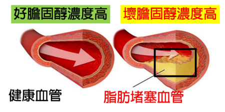 「膽固醇」不是越低越好！營養師教你提升體內「優質膽固醇」6種方法：有效降低壞膽固醇，杜絕心血管疾病！