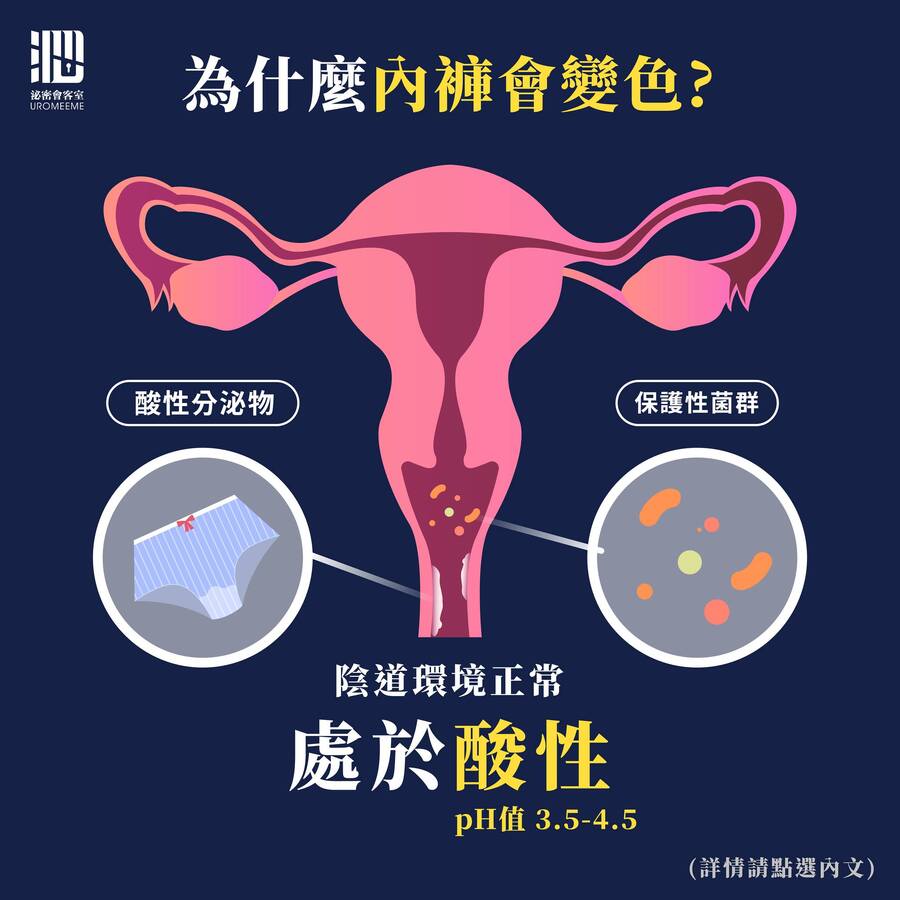 為什麼內褲會變色？（圖／泌密會客室提供）