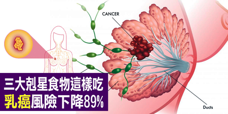 罹癌風險下降89%：三大「乳癌剋星」食物這樣吃，抑制雌激素讓癌細胞「自動消失」！