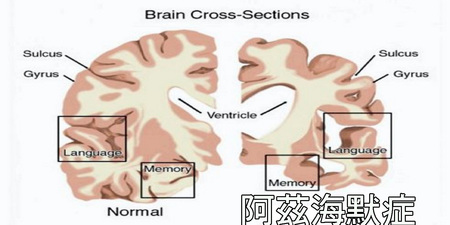 抗氧化、防「失智」的「超級維生素」：這樣吃還能降低膽固醇，讓多種「癌細胞」自動凋亡！