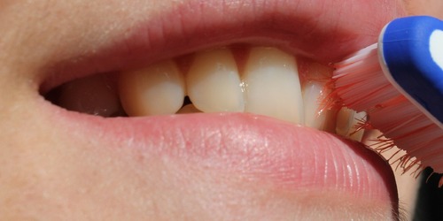 刷牙流血竟是牙周病症狀之一！5症狀自檢免得牙齒掉光