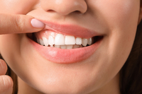 洗牙害「牙縫變大」？牙醫解迷思：牙縫露出、牙齦消腫的錯覺