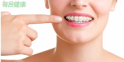 「健康的牙齒」才適合矯正！牙醫揭「4注意事項」確保成功擁有整齊漂亮的牙齒