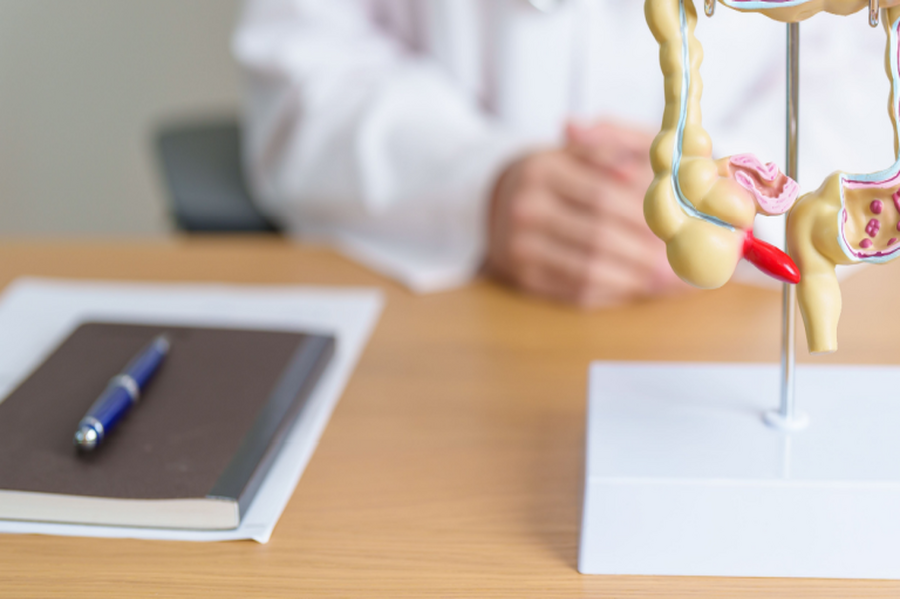 大腸癌初期無明顯症狀！ 醫：四分之一患者「確診即晚期」，及早治療有望手術切除