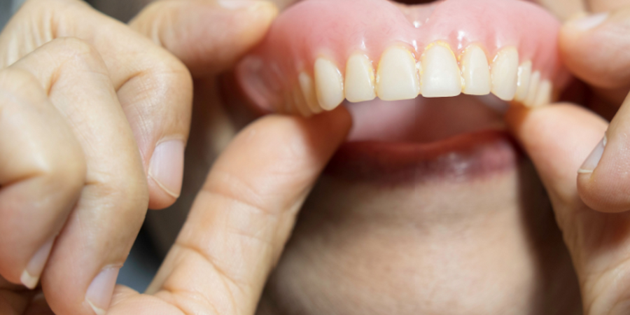 活動假牙總是黏不緊？ 醫揭真相：選對黏著劑，抹「一綠豆大」就能黏整天