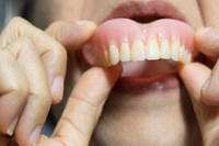 活動假牙總是黏不緊？ 醫揭真相：選對黏著劑，抹「一綠豆大」就能黏整天