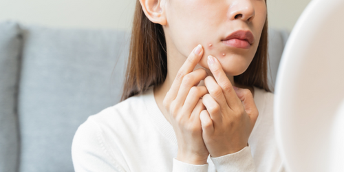 年前變美大作戰！ 新的一年直球對決「凹痘型痘疤」，醫曝1技術兼顧消疤痕、改善膚質