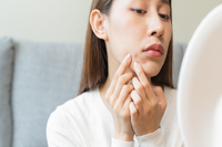 年前變美大作戰！ 新的一年直球對決「凹痘型痘疤」，醫曝1技術兼顧消疤痕、改善膚質