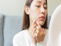 年前變美大作戰！ 新的一年直球對決「凹痘型痘疤」，醫曝1技術兼顧消疤痕、改善膚質