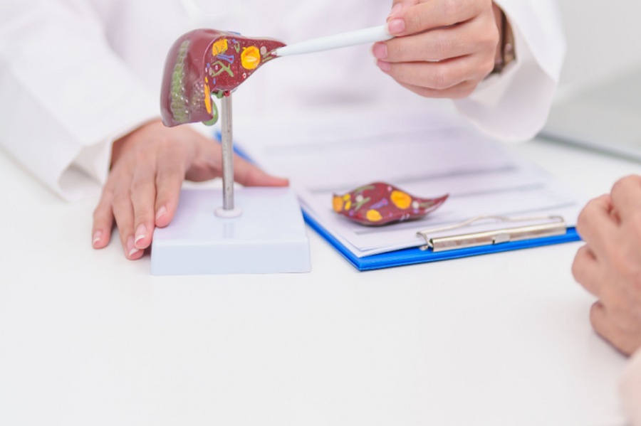 A-Lin 也曾中標！ 明明很瘦卻有脂肪肝？ 醫警告：「瘦型代謝異常」者肝癌風險更高