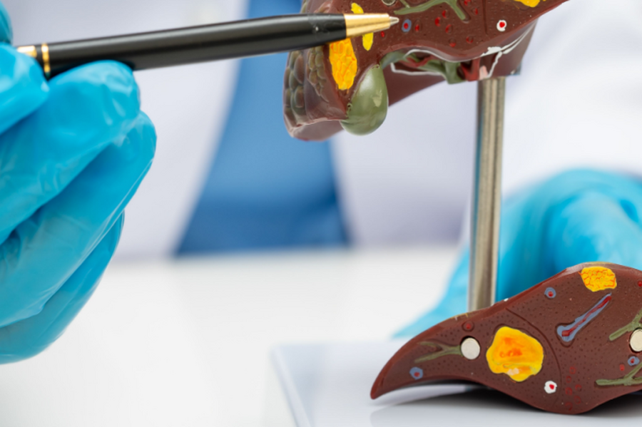 台灣脂肪肝人口超過3成！治療希望竟是 「瘦瘦筆」？ 醫證實：有望改善肝纖維化