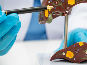 台灣脂肪肝人口超過3成！治療希望竟是 「瘦瘦筆」？ 醫證實：有望改善肝纖維化