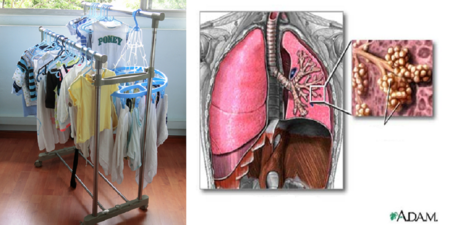 「室內晾衣」形同自製毒氣！小心「麴菌」感染引起「肺損傷」、器官發炎，嚴重可致命！