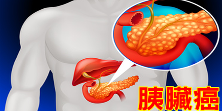 「胰臟癌」五年存活率不到3％：「8種常見食物」全方位守護胰臟健康，遠離發炎、癌變不能等！