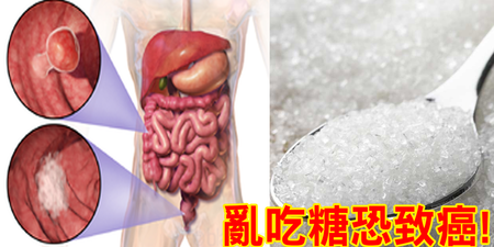 研究證實：「糖尿病」和「癌症」大有關係！再吃這種糖，當心「腫瘤瘋長」，乳癌、攝護腺癌、大腸癌全上門！