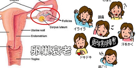 「卵巢衰老」更年期提早報到：超簡單「兩大原則」30歲起就要做！不只青春不老，還能讓「卵巢癌」風險下降74％！