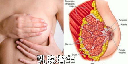 「乳房腫脹」請速就醫！當心是乳癌患者都有的「乳腺增生」，切記「兩件事」不做解除雙峰危機！