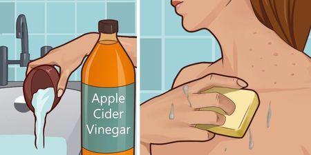 受到皮膚問題困擾嗎？使用「蘋果酒醋」的幾大好處你一定要知道！