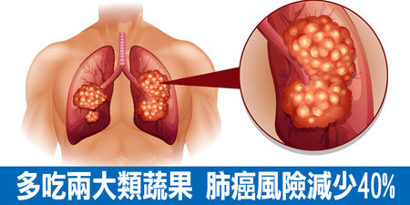 多吃兩大類蔬果，「肺癌」風險減少40%｜每日健康 Health