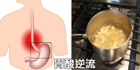 「胃酸逆流」怎麼辦？三步驟自製「薑茶」緩解成效最佳｜每日健康Health