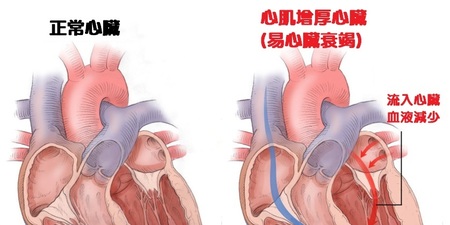 要活就要動！每日多動「一刻鐘」，擊退「心臟衰竭」多輕鬆！