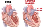 要活就要動！每日多動「一刻鐘」，擊退「心臟衰竭」多輕鬆！