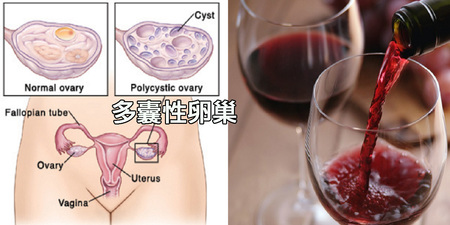 緩解「多囊性卵巢」就靠這一杯：每天喝自救「激素失衡」，甚至可改善糖尿病！｜每日健康 Health