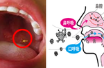 千萬別再用「嘴巴」呼吸！扁桃腺和內臟器官都是被「吸」壞的，你連吐氣都吐錯了！