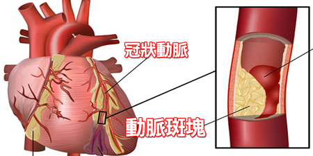 別被騙了，「低脂」食物更容易「阻塞動脈」！九大「通血食材」這樣吃，讓堵住的動脈「軟回來」｜每日健康 Health