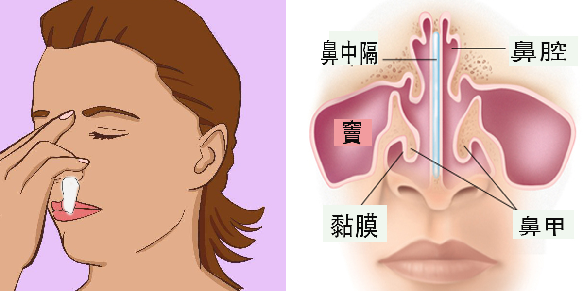 你注意過流鼻血時是 單邊 雙邊 嗎 除了擤鼻涕 過度用力 還要注意哪些隱藏危機 每日健康health 每日健康health