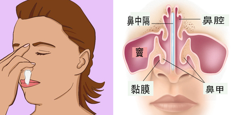 你注意過流鼻血時是「單邊」、「雙邊」嗎？除了擤鼻涕「過度用力」還要注意哪些隱藏危機？｜每日健康Health