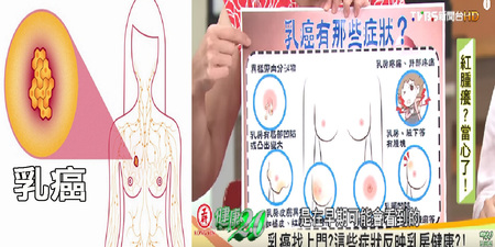 台灣「乳癌」發生率、死亡率不斷上升：記住「9大警訊」，及早治療「存活率」超過九成！｜每日健康 Health